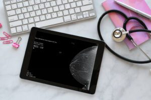 How often should you get a mammogram